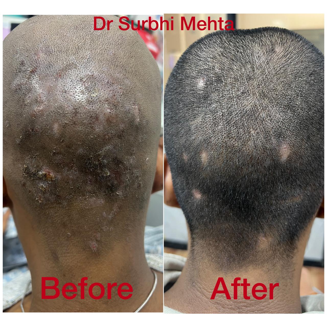 Dr. Surbhi Mehta's patient feedback